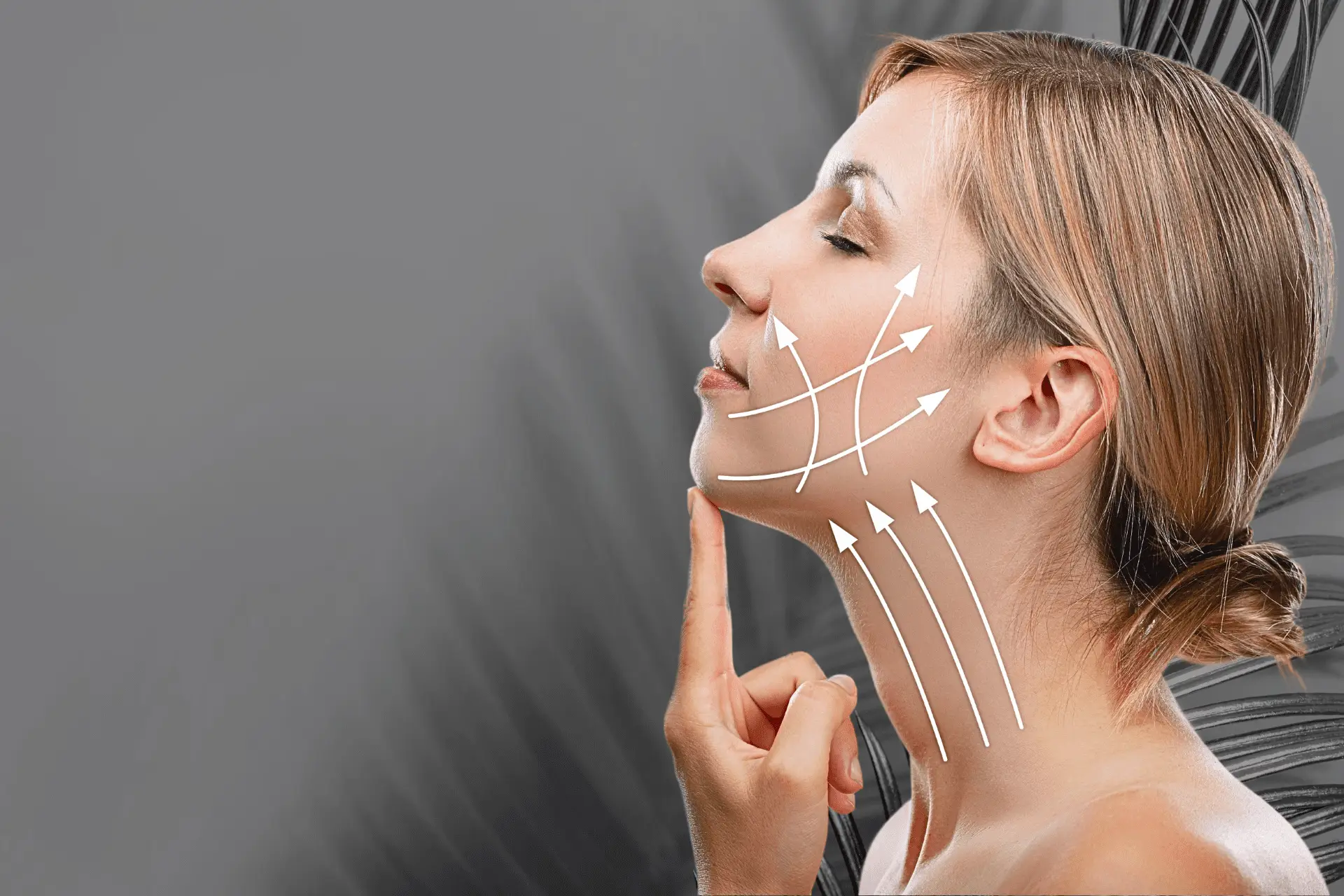 Collagen Mono Threads